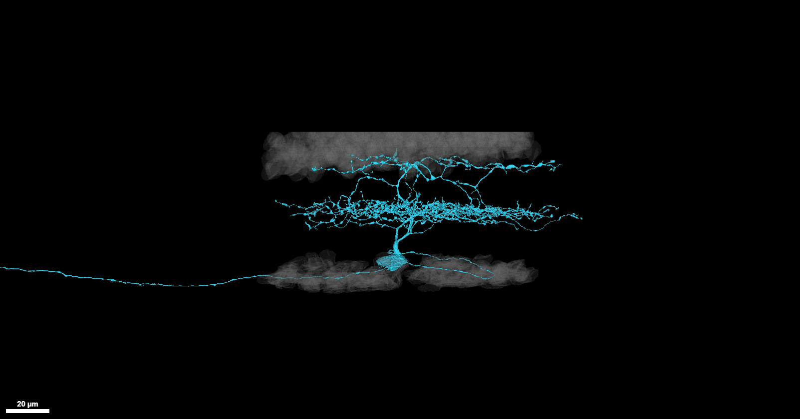 Local edge detector example