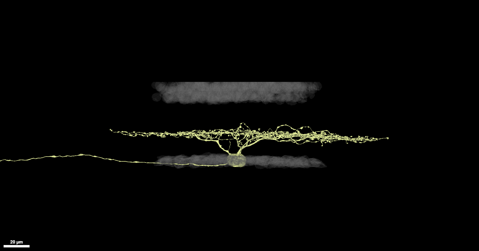 ON transient medium RF example
